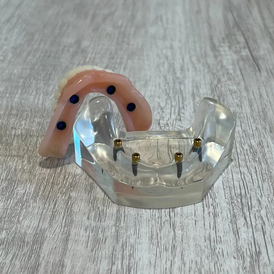 snap-in implant dentures Chester Springs, PA